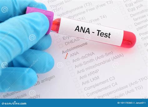 ANA test stock image. Image of equipment, experiment - 101170365