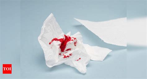 5-step first aid plan to stop excessive bleeding - Times of India