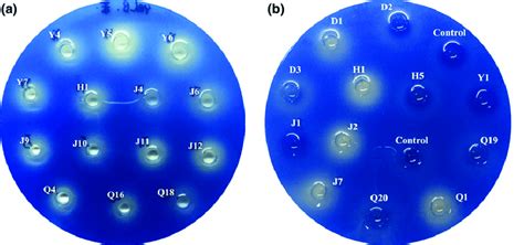 The decolorization of aniline blue by the selected strains cultured on ...