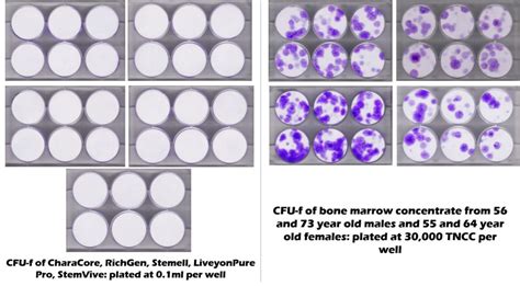 Umbilical Cord Stem Cell Therapy for Knees - Regenexx Blog