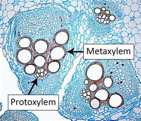 Types of Plant Cell- Definition, Structure, Functions, Labeled Diagram