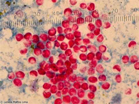 Oocistos de Cryptosporidium spp | Fotografias Microscópicas e Macroscópicas | Atlas de ...