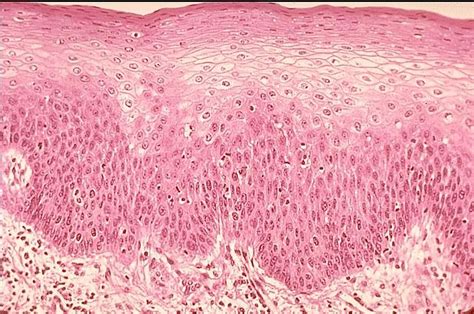 stratified squamous tissue 400 | Stratified Squamous Epithelial Tissue ...