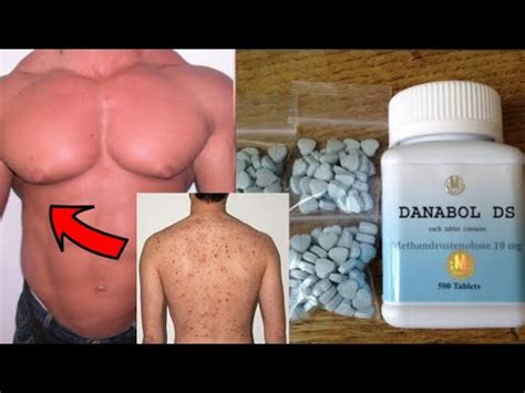 Dianabol Side effects - YouTube