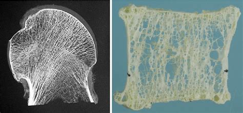 Figure 2 from Characterisation of Trabecular Bone Structure | Semantic ...