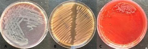 Colony morphology of Proteus spp. on XLD (A), MacConkey (B), and blood... | Download Scientific ...