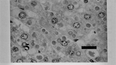 -High magnification of Fig. 4. Small inclusion bodies in the cytoplasm ...