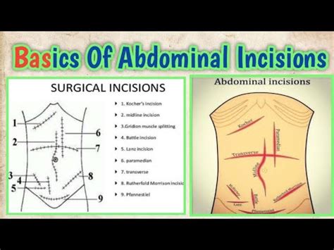 Incision mp4 3gp flv mp3 video indir