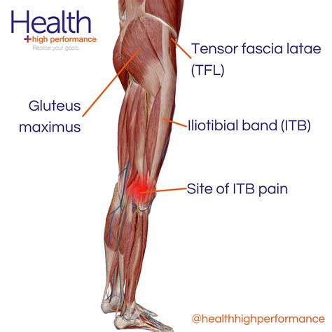 Iliotibial Band Syndrome Wikipedia | atelier-yuwa.ciao.jp