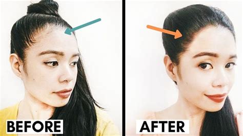 Methods I'm Using to Grow Back a Fuller Hairline- Receding Hairline Regr... | Hair growing tips ...