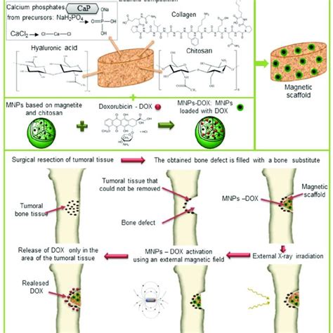 Treatment of bone tumors using radiotherapy and targeted chemotherapy. | Download Scientific Diagram