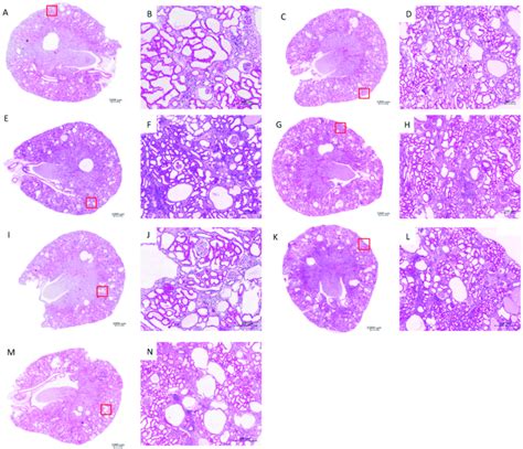 Haematoxylin and eosin (H&E) staining of PKD/Mhm (Cy/+) rat kidneys.... | Download Scientific ...