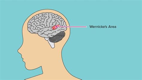 Wernicke's Aphasia: Symptoms, Causes, and Treatment | Aphasia, Wernicke ...