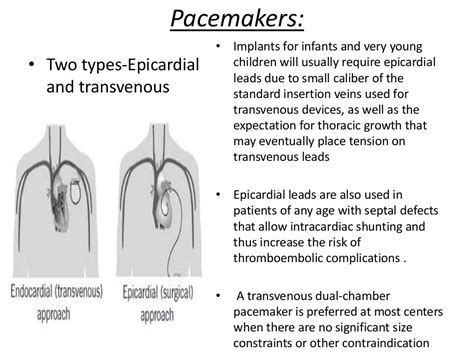 Congenital heart block