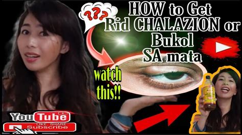 HOME REMEDIES FOR CHALAZION OR BUKOL SA MATA||EASY AND EFFECTIVE ...