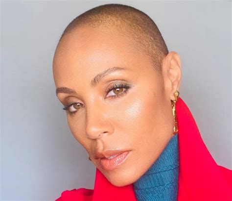 What's alopecia, the condition that made Jada Pinkett Smith shave her head?