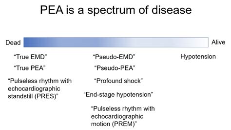 Management of PEA: in need of resuscitation? - EMOttawa Blog