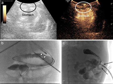 A 9-month-old boy with congenital heart disease. a Dual-screen mode... | Download Scientific Diagram