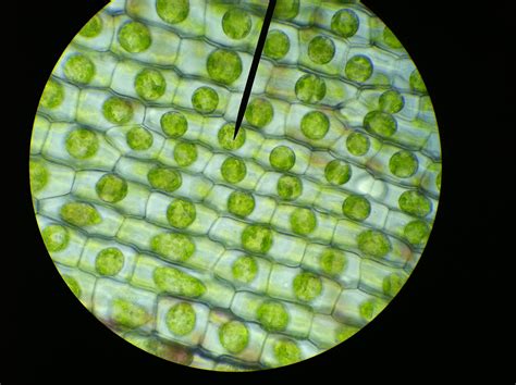 Hypertonic Plant Cell