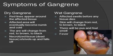 Gangrene - Assignment Point