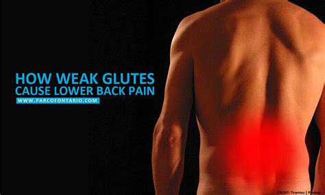 How Weak Glutes Cause Lower Back Pain | The Physiotherapy and ...