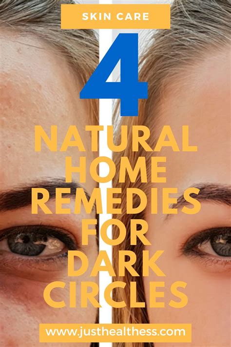 4 Natural Home Remedies For Dark Circles #darkcircles #skincare