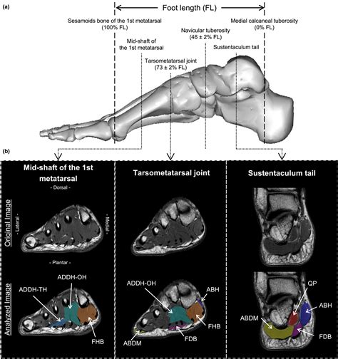 Associations of muscle volume of individual human plantar intrinsic ...