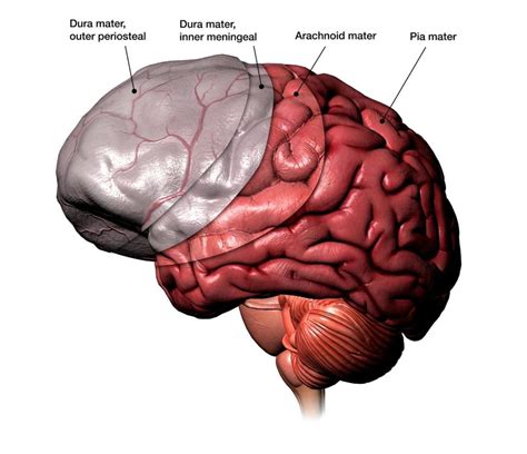 Meningioma - Dott. François LECHANOINE