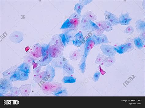 Squamous Epithelial Image & Photo (Free Trial) | Bigstock