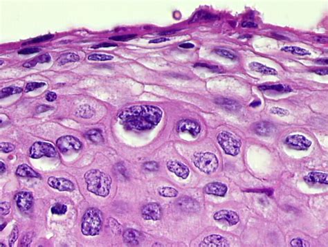 Histopathology of the uterine cervix - digital atlas