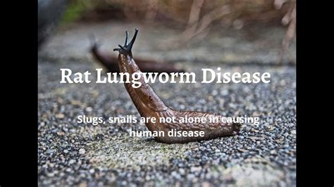 Rat Lungworm Disease: Slugs, snails are not alone in causing human disease - YouTube