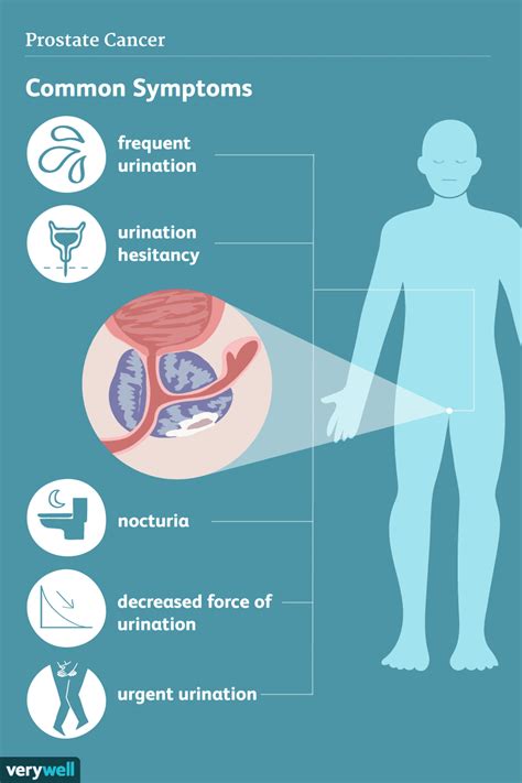 Enlarged Prostate: Overview and More