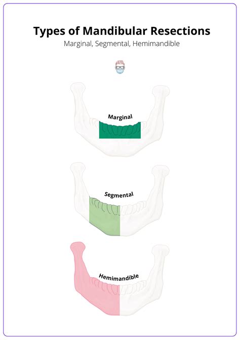 Mandibular Defects · Classification & Reconstruction