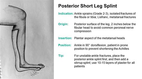 SplintER Series: Common ED Splint Techniques | Splint Principles 104