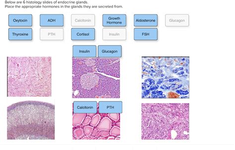 Solved Below are 6 histology slides of endocrine glands. | Chegg.com