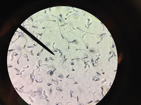 Microscopic image of sperm cells : r/pics