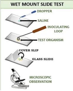 Wet Mount Motility Test - Introduction, Principle, Procedure, Result ...