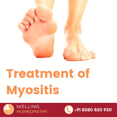 Homeopathy Treatment of Myositis – Welling Homeopathy