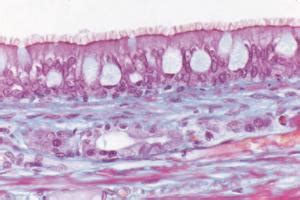 Pseudostratified, Ciliated, Columnar Epithelium Slides | Ward's Science