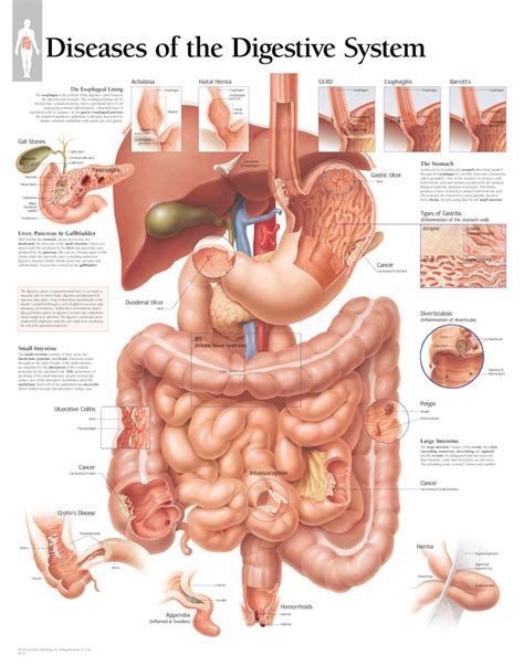 Diseases of Digestive System | Digestive system anatomy, Digestive system, Human digestive system