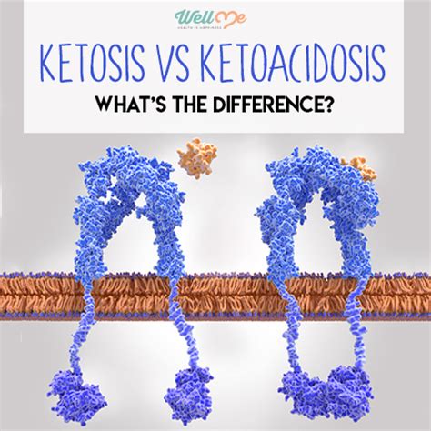 Ketosis vs Ketoacidosis: What’s the Difference? | WellMe