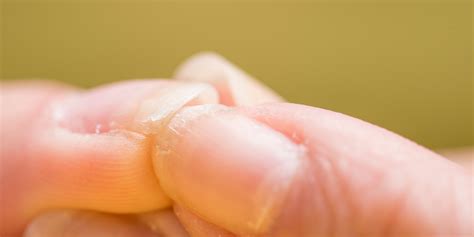 10 Reasons For Brittle Nails - Causes and Treatments for Weak Nails