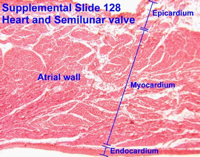 Heart Endocardium Histology