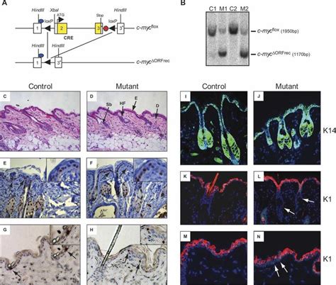 Induced deletion of the c-myc gene in the adult mouse epidermis. (A ...