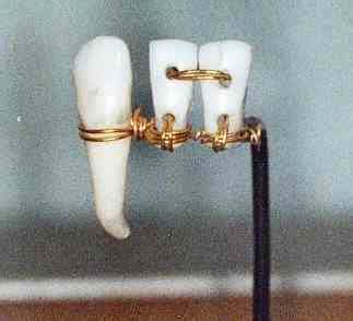 Ancient Egyptian Dentistry - DentalSave Dental Plans