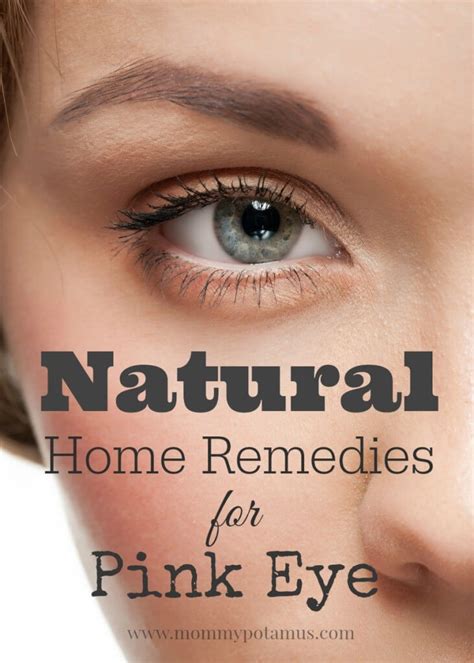 5 Natural Remedies For Pink Eye