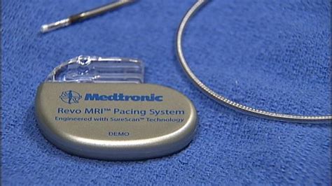 Medtronic, St. Jude Medical Compete for Brand Loyalty in Europe ...