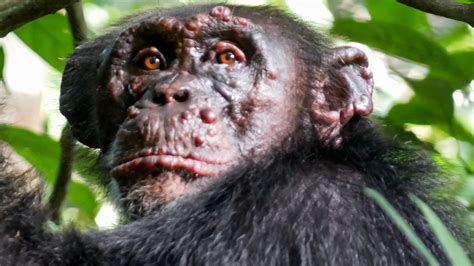 Leprosy, ancient scourge of humans, found to assail wild chimpanzees ...