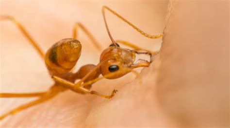 Ant Bites Identification, Types, Pictures, Symptoms, Allergic Reaction ...