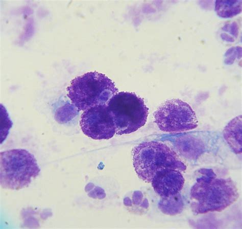 Pathology Outlines - Mast cells